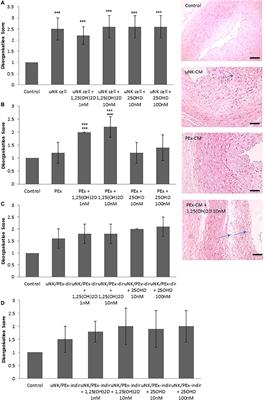 Vitamin D Promotes Trophoblast Cell Induced Separation of Vascular Smooth Muscle Cells in Vascular Remodeling via Induction of G-CSF